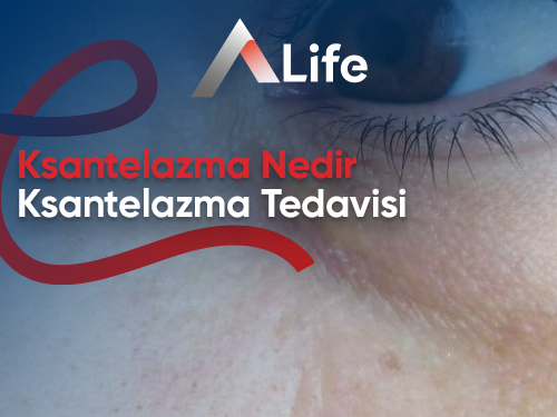 Ksantelazma Nedir? Ksantelazma Tedavisi?